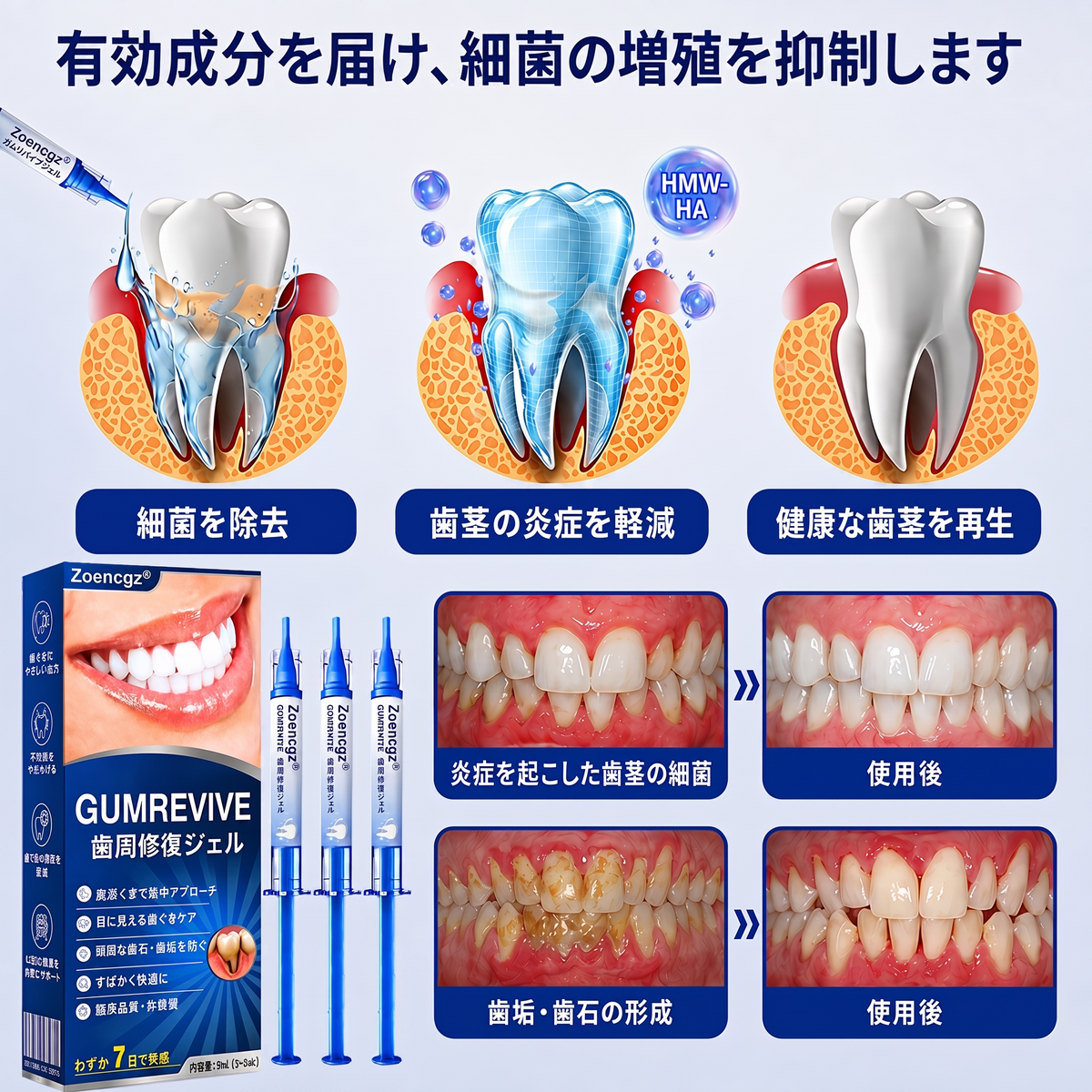 🇯🇵🦷🥄Zoencgz® 歯ぐきケア抗菌ジェル｜7日間で目指す健やかな口内環境