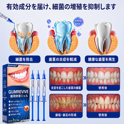 🇯🇵🦷🥄Zoencgz® 歯ぐきケア抗菌ジェル｜7日間で目指す健やかな口内環境