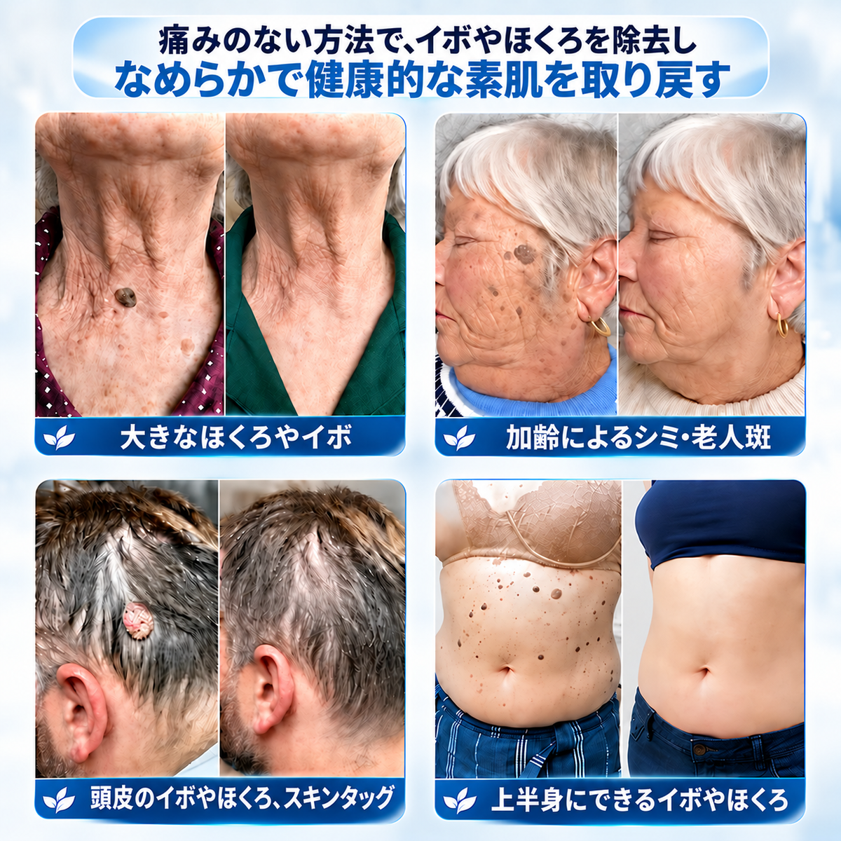 𝐇𝐞𝐚𝐥𝐫𝐢𝐳𝐞® ✨2️⃣ 肌のイボや気になる色素沈着を7日間集中ケア（やさしい処方で痛みなし・跡が残りにくい）🌿