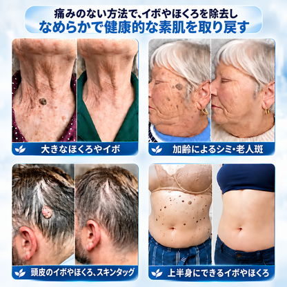 𝐇𝐞𝐚𝐥𝐫𝐢𝐳𝐞® ✨2️⃣ 肌のイボや気になる色素沈着を7日間集中ケア（やさしい処方で痛みなし・跡が残りにくい）🌿
