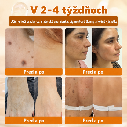 🐝🍇 Healrize® Komplexný krém na tvár s včelím jedom – Nová generácia prírodnej starostlivosti o pleť pre hydratovanejšiu, hladšiu a žiarivejšiu pokožku 🌿✨