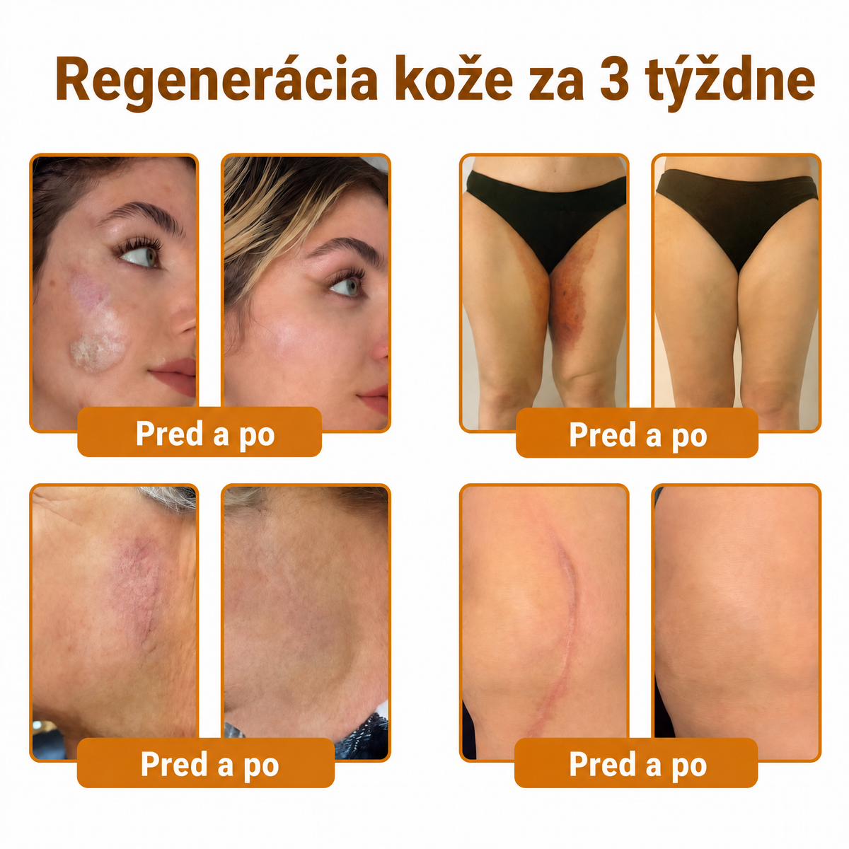 🐝🍇 Healrize® Komplexný krém na tvár s včelím jedom – Nová generácia prírodnej starostlivosti o pleť pre hydratovanejšiu, hladšiu a žiarivejšiu pokožku 🌿✨