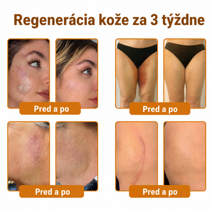 🐝🍇 Healrize® Komplexný krém na tvár s včelím jedom – Nová generácia prírodnej starostlivosti o pleť pre hydratovanejšiu, hladšiu a žiarivejšiu pokožku 🌿✨