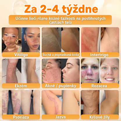 🐝🍇 Healrize® Komplexný krém na tvár s včelím jedom – Nová generácia prírodnej starostlivosti o pleť pre hydratovanejšiu, hladšiu a žiarivejšiu pokožku 🌿✨