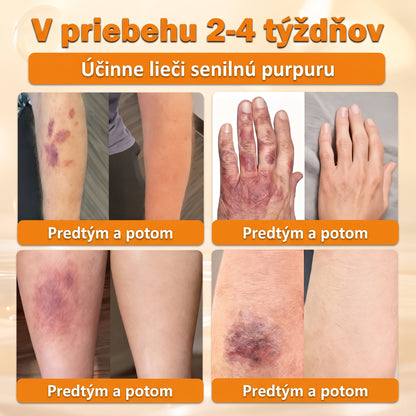 🐝🍇 Healrize® Komplexný krém na tvár s včelím jedom – Nová generácia prírodnej starostlivosti o pleť pre hydratovanejšiu, hladšiu a žiarivejšiu pokožku 🌿✨