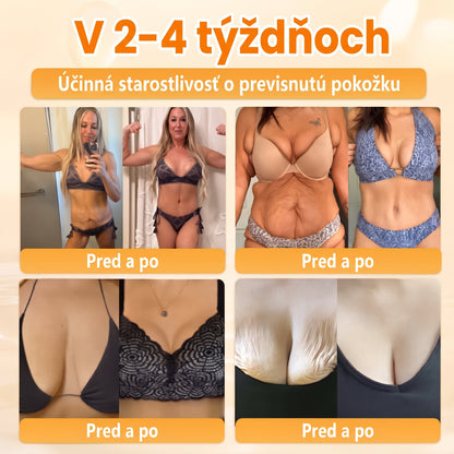 🐝🍇 Healrize® Komplexný krém na tvár s včelím jedom – Nová generácia prírodnej starostlivosti o pleť pre hydratovanejšiu, hladšiu a žiarivejšiu pokožku 🌿✨