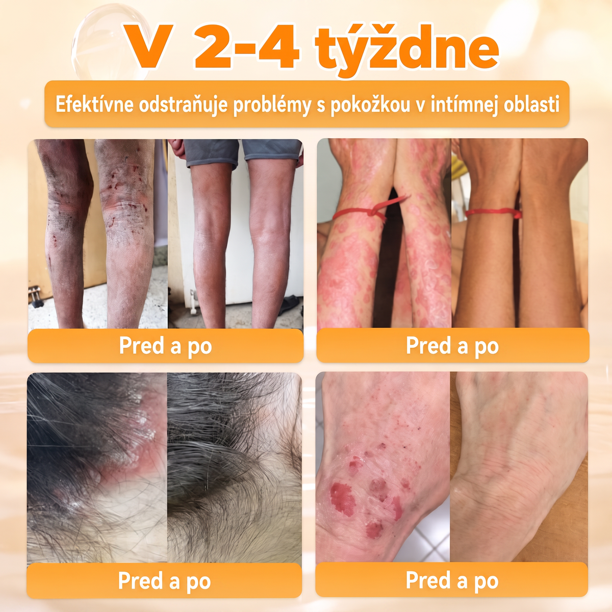 🐝🍇 Healrize® Komplexný krém na tvár s včelím jedom – Nová generácia prírodnej starostlivosti o pleť pre hydratovanejšiu, hladšiu a žiarivejšiu pokožku 🌿✨