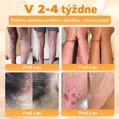 🐝🍇 Healrize® Komplexný krém na tvár s včelím jedom – Nová generácia prírodnej starostlivosti o pleť pre hydratovanejšiu, hladšiu a žiarivejšiu pokožku 🌿✨