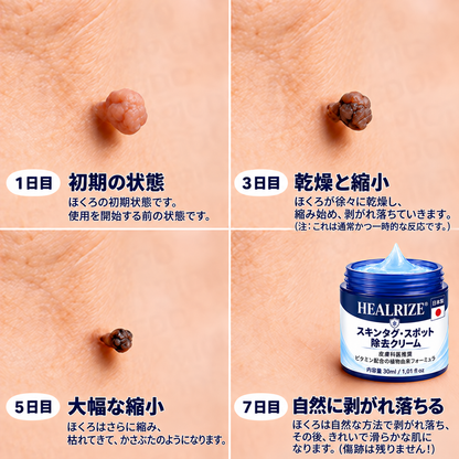 𝐇𝐞𝐚𝐥𝐫𝐢𝐳𝐞® ✨2️⃣ 肌のイボや気になる色素沈着を7日間集中ケア（やさしい処方で痛みなし・跡が残りにくい）🌿