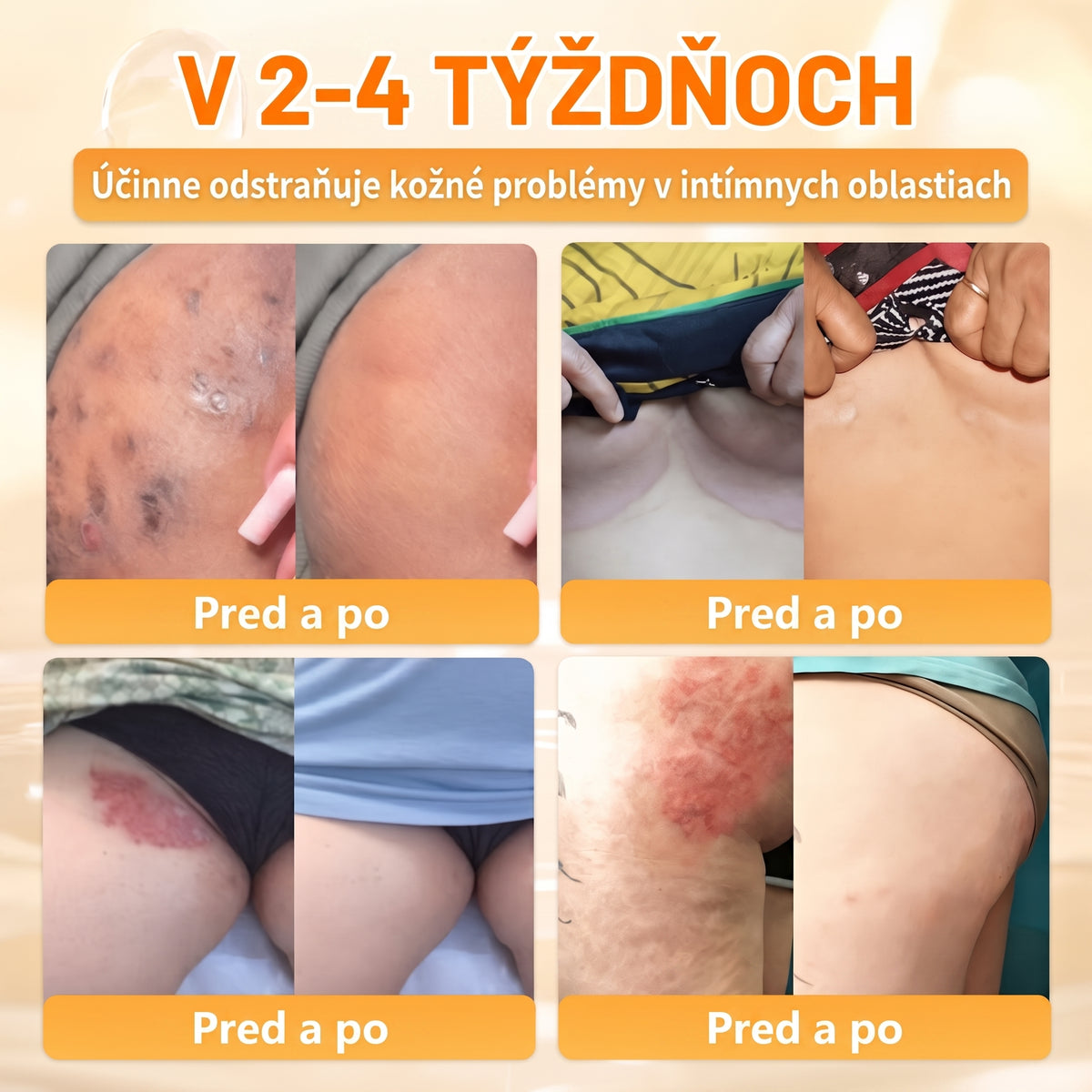 🐝🍇 Healrize® Komplexný krém na tvár s včelím jedom – Nová generácia prírodnej starostlivosti o pleť pre hydratovanejšiu, hladšiu a žiarivejšiu pokožku 🌿✨