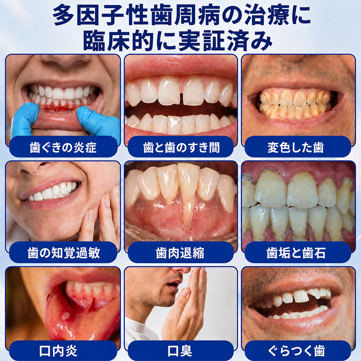 🇯🇵🦷🥄Zoencgz® 歯ぐきケア抗菌ジェル｜7日間で目指す健やかな口内環境